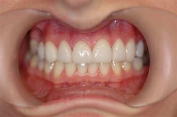Children’s cosmetic dental treatment to end