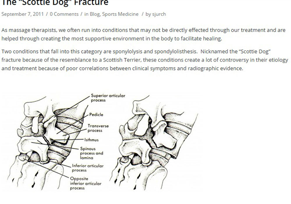Picture shows a fracture and severe trauma to the spine 
