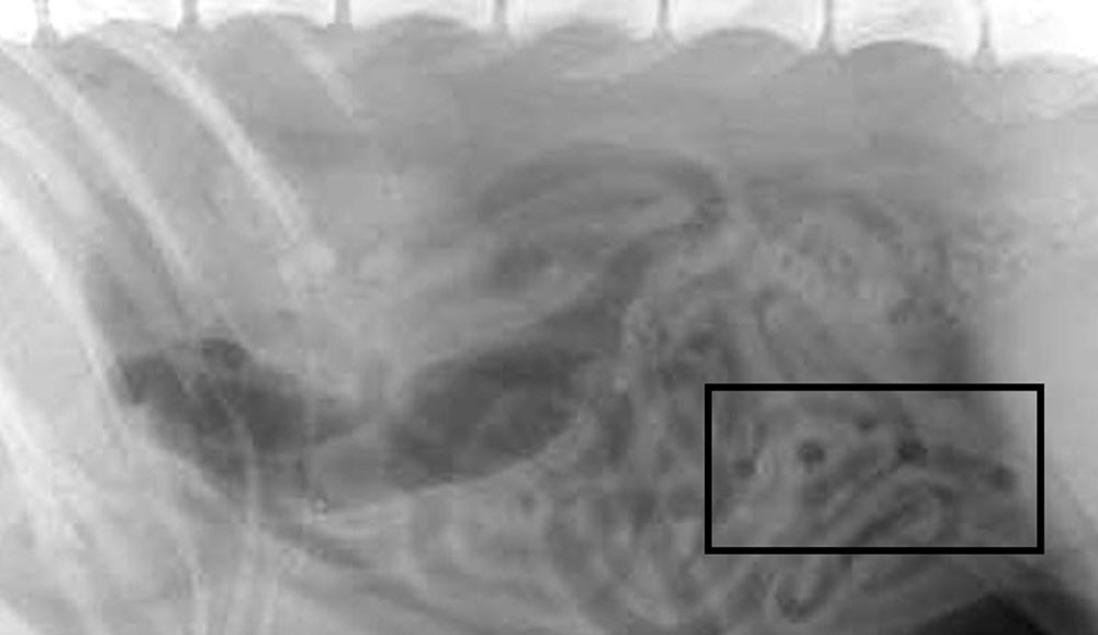X-rays show the shards blocking his intestines 