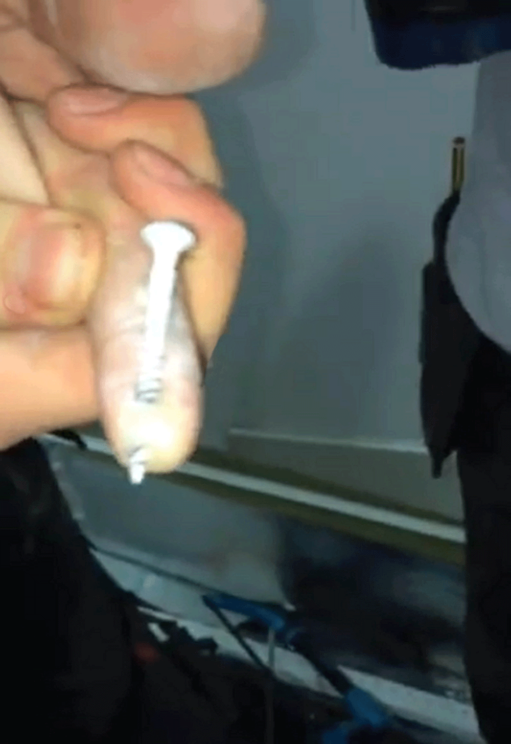 The screw stuck through the finger