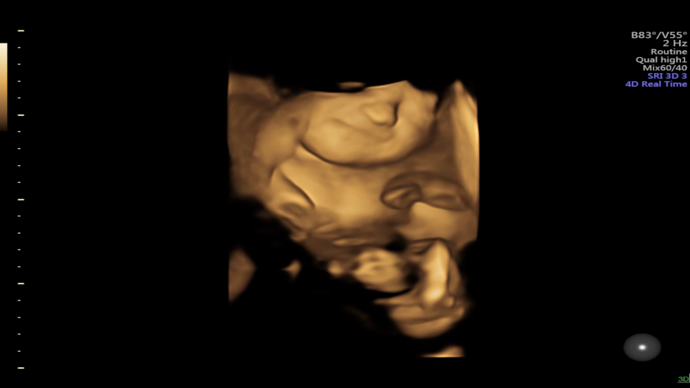 A 4D ultrasound image showing a baby smiling - Credit - University of Dundee - Research News Scotland