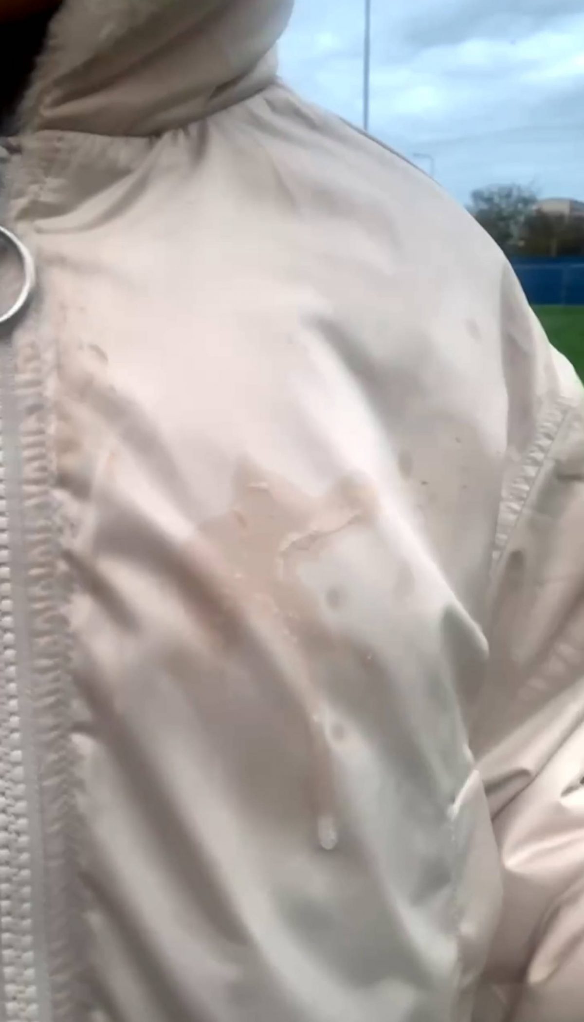 The spit on Yanice's jacket