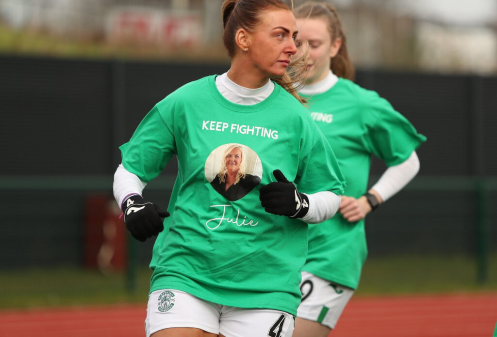 Hibs players warm up bearing shirts with well wishes